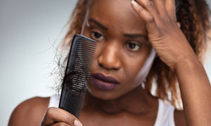 What Black Women Need To Know About Hair Loss